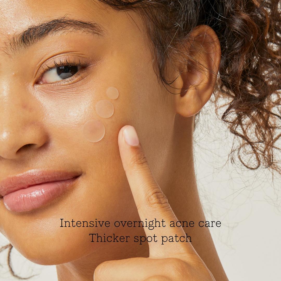 COSRX Acne Pimple Master Patch overnight blemish results
