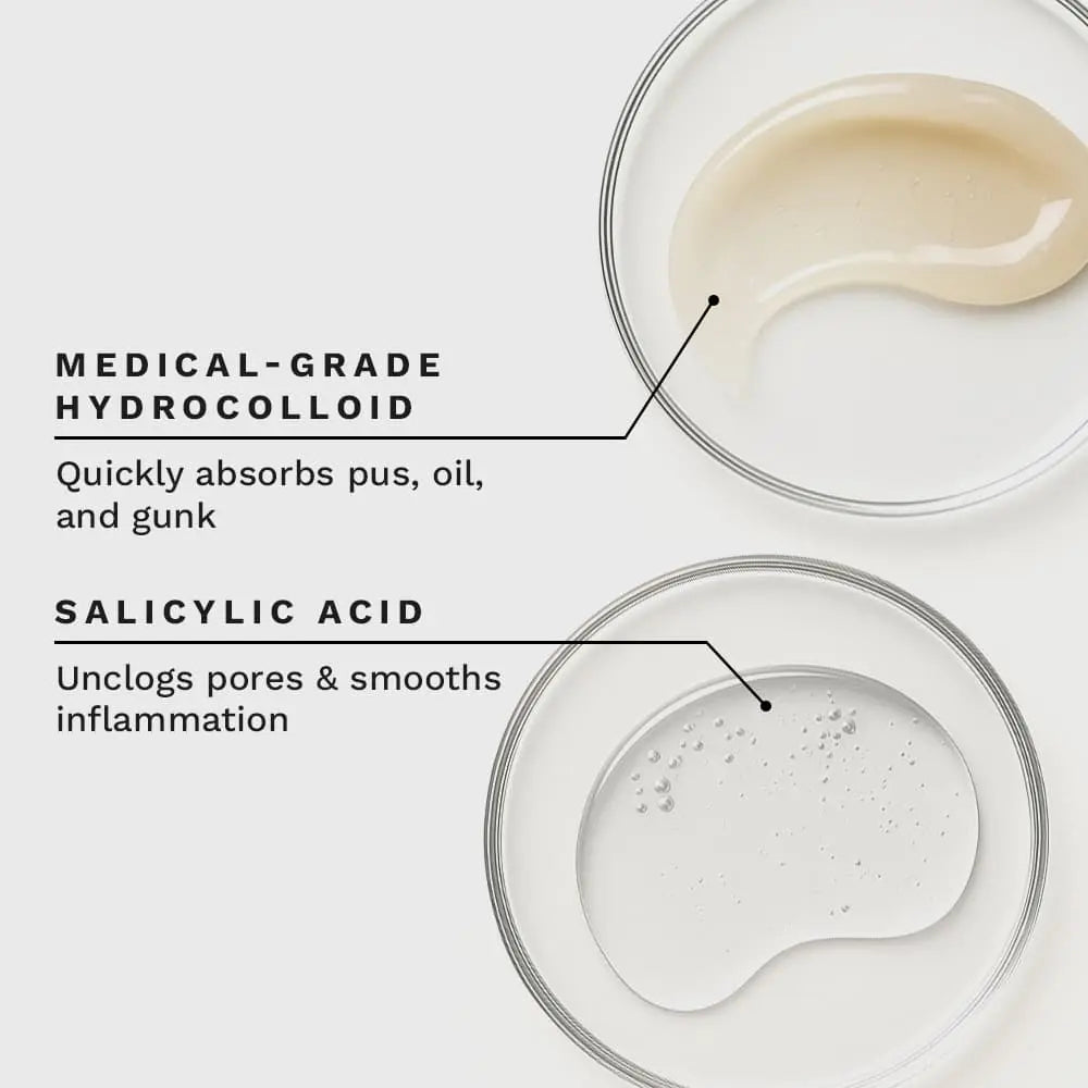 Clearly Basics Invisible Acne Patch pimple absorption results